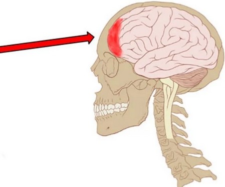 когда болит голова лобовая часть