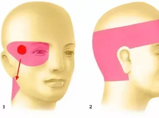 сильно болит пол головы и глаз