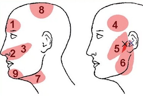 почему часто болят виски и голова