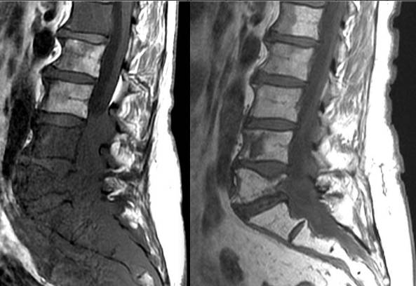 На спине шишка которая болит