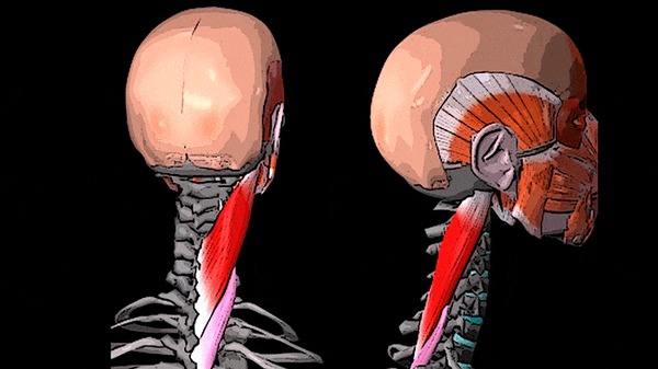 ÁÎËÈÒ ÃÎËÎÂÀ È ØÅß: ðåìåííàÿ ìûøöà ãîëîâû è øåè Çäîðîâüå, Ìåäèöèíà, Ìàññàæ, Àíàòîìèÿ, Âèäåî, Ãèôêà, Äëèííîïîñò