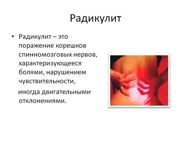 Почему болит спина в области поясницы и отдает в ногу