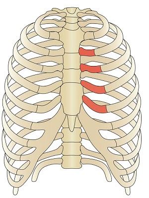 болит при вздохе правые ребра со спины
