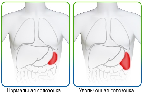 почему болит подреберье и спина