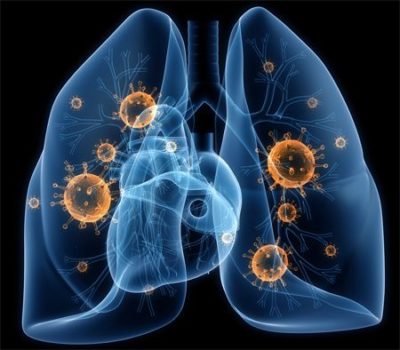 Очень сильно болит правый бок и отдает в спину что это может быть