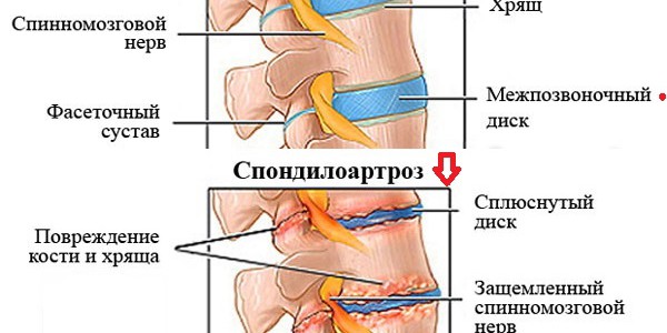 Все названия болезней когда болит спина