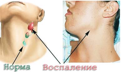 Болит внизу спина температура