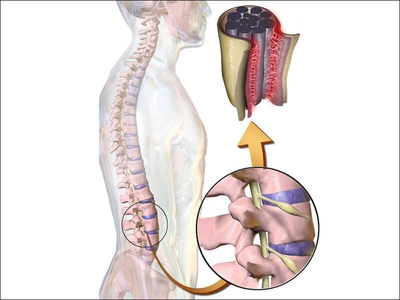 О ЧЕМ говорит появления БОЛИ в спине справа О ЧЕМ говорит появления БОЛИ в спине справа