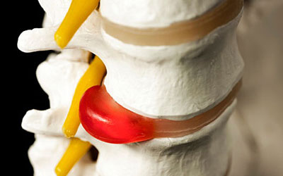 от чего болит спина по ночам в пояснице