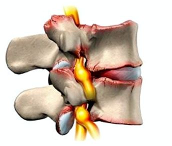 болит при вздохе правые ребра со спины