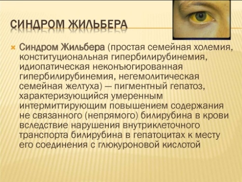синдром Жильбера