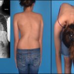 На вдохе болит грудная клетка и отдает в спину