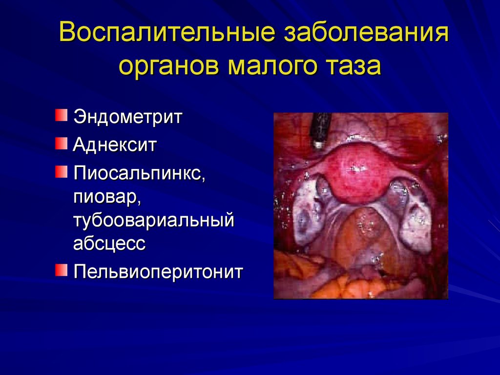 Почему болит спина в области поясницы и отдает в ногу